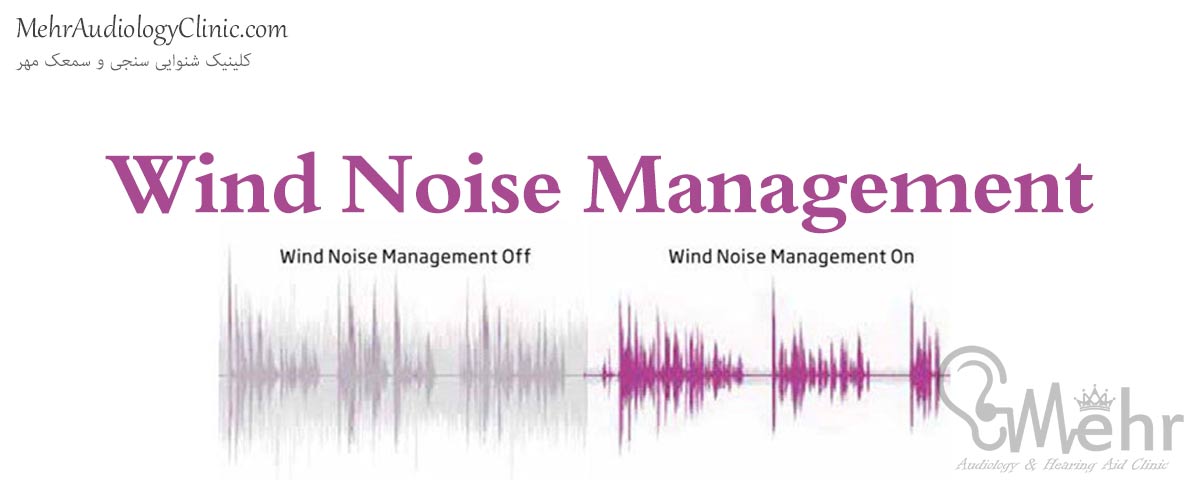 Wind Noise Management